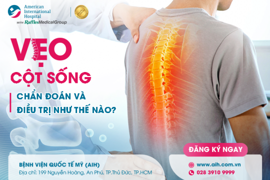 VẸO CỘT SỐNG: CHẨN ĐOÁN VÀ ĐIỀU TRỊ NHƯ THẾ NÀO?