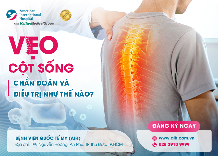 VẸO CỘT SỐNG: CHẨN ĐOÁN VÀ ĐIỀU TRỊ NHƯ THẾ NÀO?