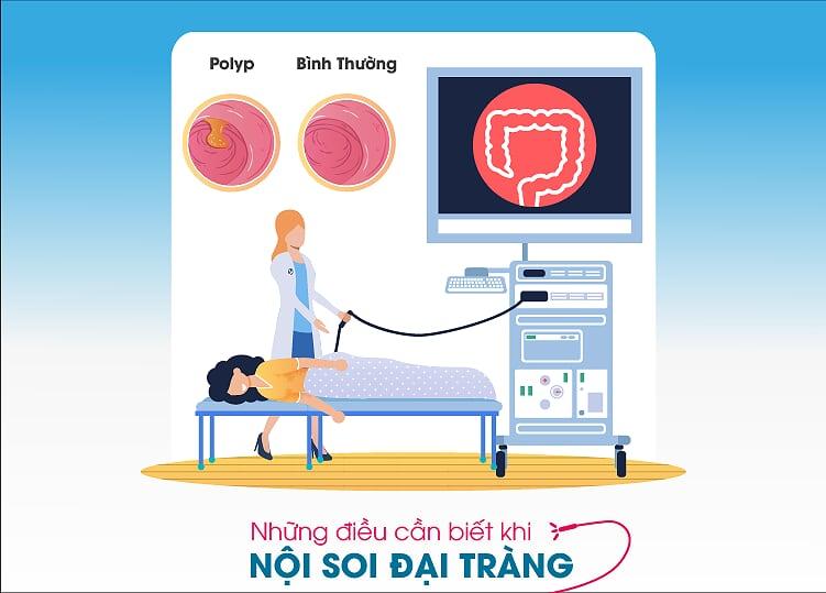 WHAT TO EXPECT WITH A COLONOSCOPY