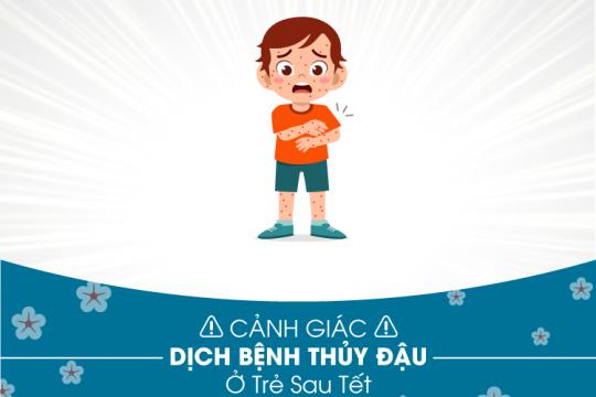 CẢNH GIÁC DỊCH BỆNH THỦY ĐẬU Ở TRẺ SAU TẾT