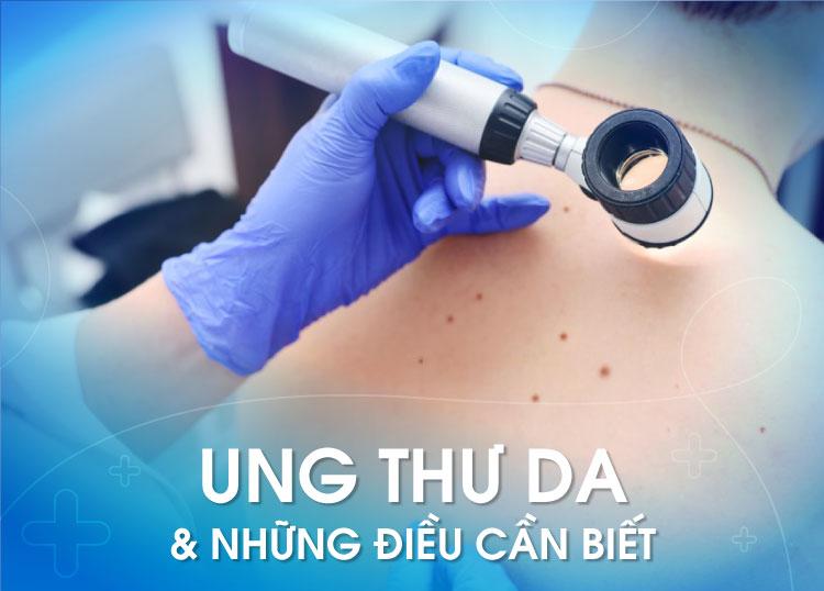 SKIN CANCER: WHAT YOU SHOULD KNOW