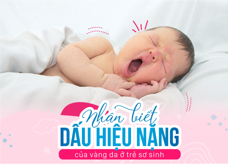 NHẬN BIẾT DẤU HIỆU NẶNG CỦA VÀNG DA Ở TRẺ SƠ SINH