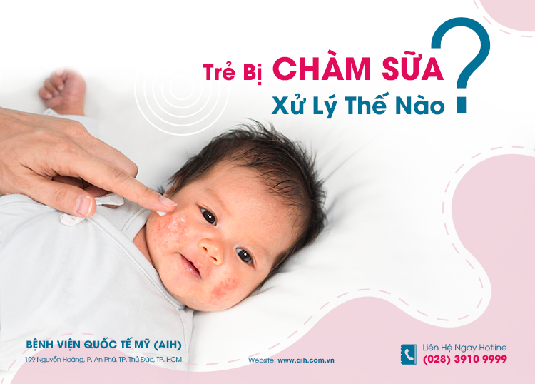 TRẺ BỊ CHÀM SỮA, XỬ LÝ THẾ NÀO?​