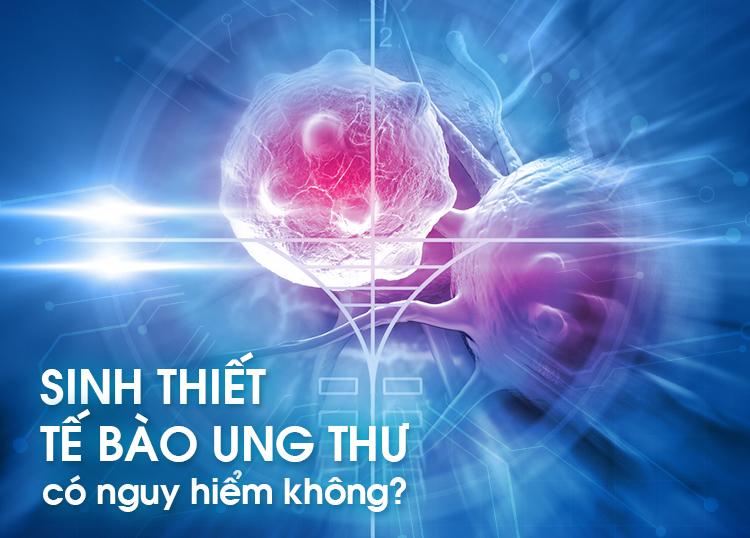 SINH THIẾT XÁC ĐỊNH TẾ BÀO UNG THƯ CÓ NGUY HIỂM KHÔNG?
