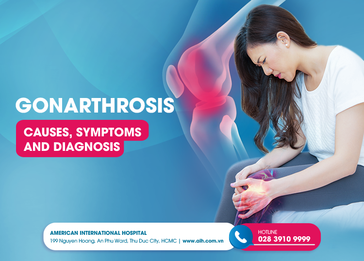 GONARTHROSIS: CAUSES, SYMPTOMS AND DIAGNOSIS